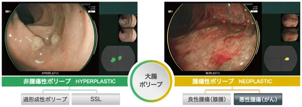 診断支援モード イメージ